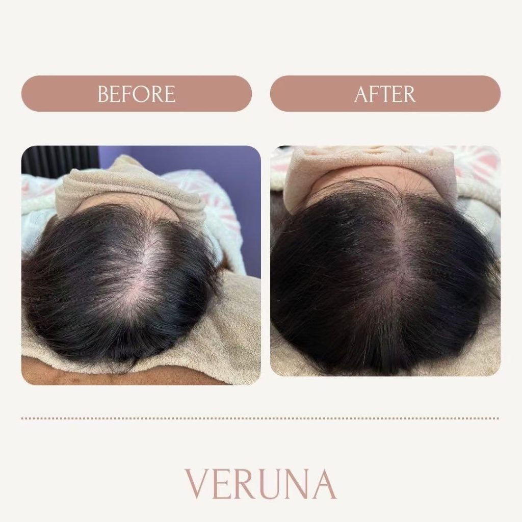 スカルプケア　育毛ケア
抜け毛ケア